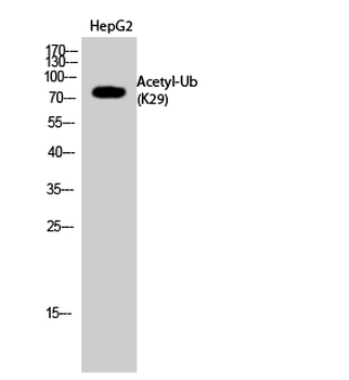 Ub (Acetyl Lys29) Polyclonal Antibody