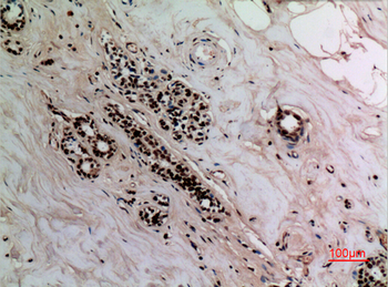 NFκB-p65 (Acetyl Lys314/Lys315) Polyclonal Antibody
