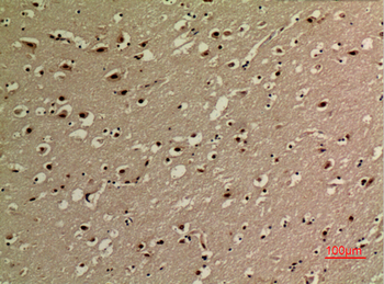 NFκB-p65 (Acetyl Lys314/Lys315) Polyclonal Antibody