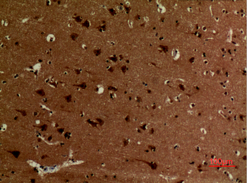 Ub (Acetyl Lys27) Polyclonal Antibody