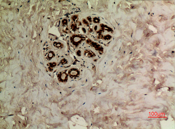 Tubulin α (Acetyl Lys40) Polyclonal Antibody
