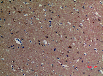 Tubulin α (Acetyl Lys40) Polyclonal Antibody