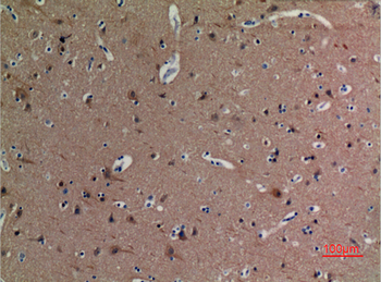Tubulin α (Acetyl Lys40) Polyclonal Antibody
