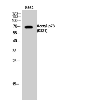 p73 (Acetyl Lys321) Polyclonal Antibody