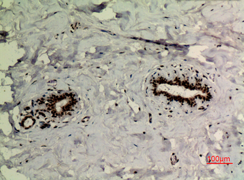 p73 (Acetyl Lys321) Polyclonal Antibody