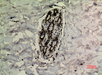 p73 (Acetyl Lys321) Polyclonal Antibody
