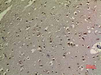 p73 (Acetyl Lys321) Polyclonal Antibody