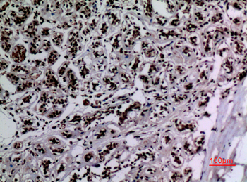 HSP 90 (Acetyl Lys292/284) Polyclonal Antibody