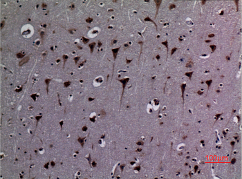 HSP 90 (Acetyl Lys292/284) Polyclonal Antibody