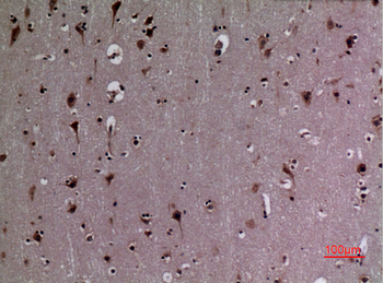 HSP 90 (Acetyl Lys292/284) Polyclonal Antibody
