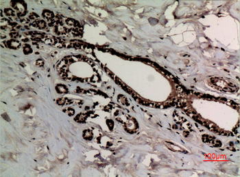 Histone H3 (Di Methyl Lys10) Polyclonal Antibody