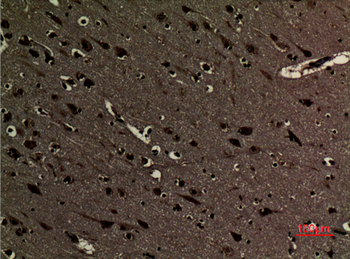 Histone H3 (Di Methyl Lys5) Polyclonal Antibody