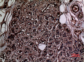 Histone H3 (Mono Methyl Lys5) Polyclonal Antibody