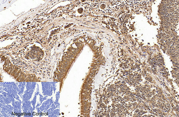 Cleaved-PARP-1 (D214) Polyclonal Antibody