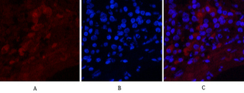 Cleaved-Notch 1 (V1754) Polyclonal Antibody