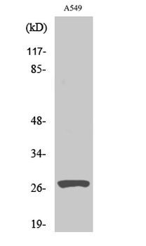 Cleaved-Cathepsin D HC (L169) Polyclonal Antibody