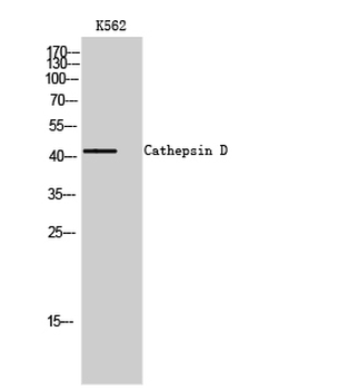 Cathepsin D Polyclonal Antibody