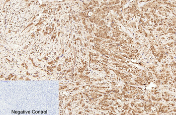 Caspase-7 Polyclonal Antibody
