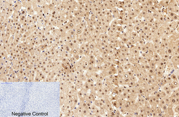 Caspase-7 Polyclonal Antibody