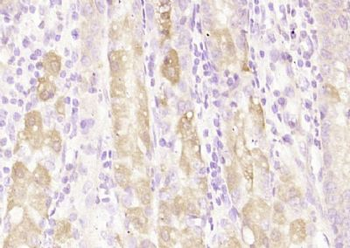 C21orf70 Polyclonal Antibody