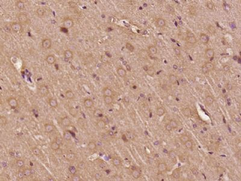 C21orf58 Polyclonal Antibody