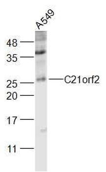 C21orf2 Polyclonal Antibody