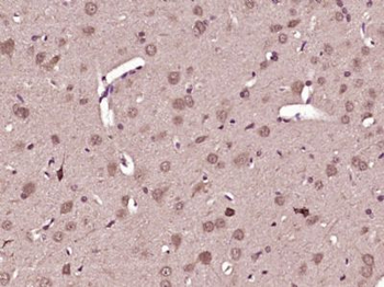 C21orf2 Polyclonal Antibody