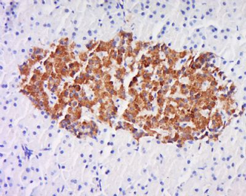 C21orf2 Polyclonal Antibody