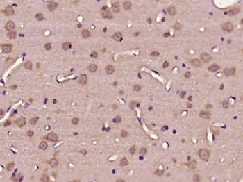 C11orf57 Polyclonal Antibody