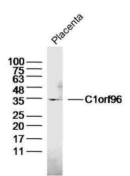 C1orf96 Polyclonal Antibody