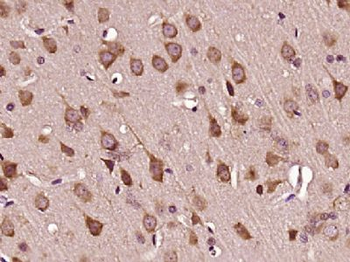 C1orf96 Polyclonal Antibody