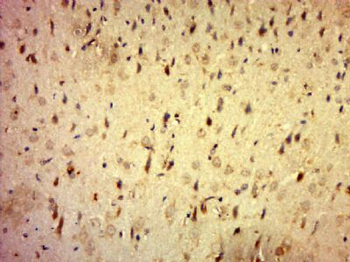 C20orf196 Polyclonal Antibody