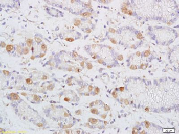 DENND2D Polyclonal Antibody