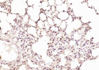 RPUSD2 Polyclonal Antibody