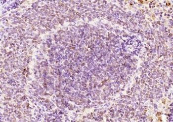 RPUSD2 Polyclonal Antibody