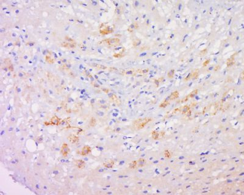 Copine-6 Polyclonal Antibody