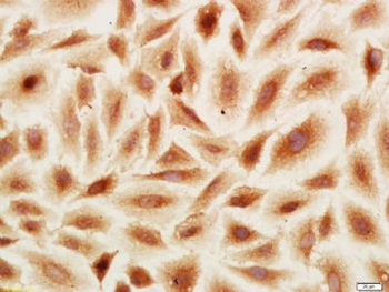 PRR15 Polyclonal Antibody