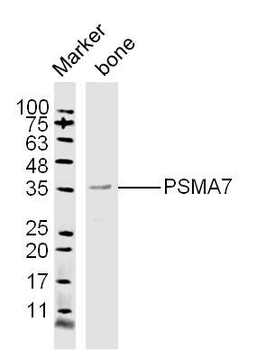PSMA7 Polyclonal Antibody