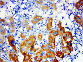 PSMA7 Polyclonal Antibody