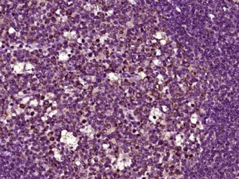 GPBAR1 Polyclonal Antibody