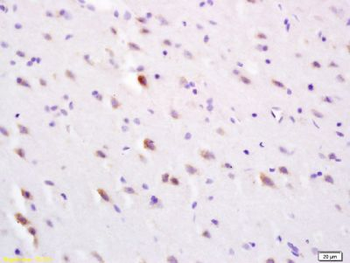 SLC30A3 Polyclonal Antibody