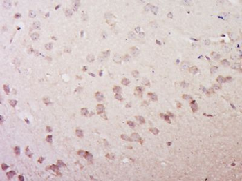 VGLUT3/SLC17A8 Polyclonal Antibody