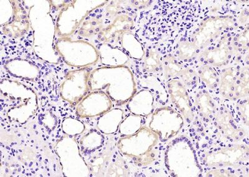 RENBP Polyclonal Antibody