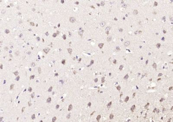 ZNF804A Polyclonal Antibody