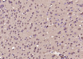 BTBD3 Polyclonal Antibody