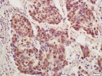 CT112 Polyclonal Antibody