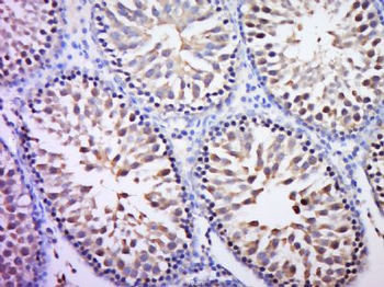 CT112 Polyclonal Antibody