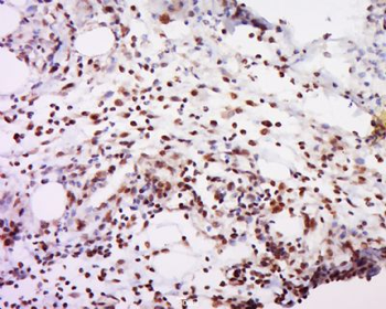 FAM113A Polyclonal Antibody