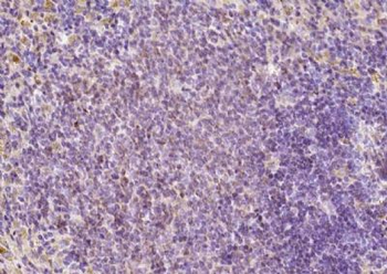 FAM46C Polyclonal Antibody