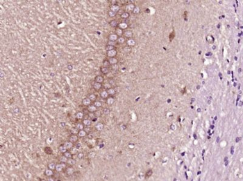 CCDC22 Polyclonal Antibody